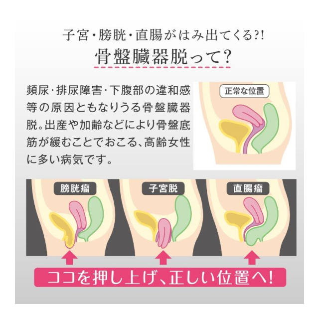 photo4